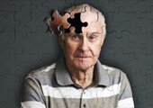 alzheimer's disease